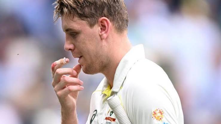 Australian allrounder Cameron Green, who is struggling with finger injury, is set to miss the 1st Test against India on 9 February in the VCA Stadium, Nagpur