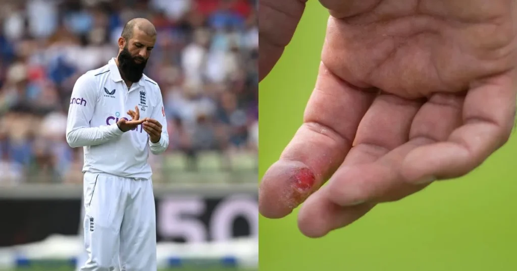 Ashes 2023: Eoin Morgan Discusses Moeen Ali's Finger Injury and ICC Code of Conduct Breach, Cites Ravindra Jadeja's Previous Fine